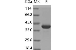 Western Blotting (WB) image for Malate Dehydrogenase 1, NAD (Soluble) (MDH1) protein (His tag) (ABIN7321179)
