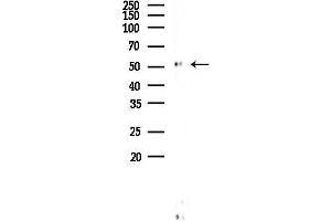 Western blot analysis of lysates from HUVEC cells, using EPHX1 Antibody at 1/1000 dilution.