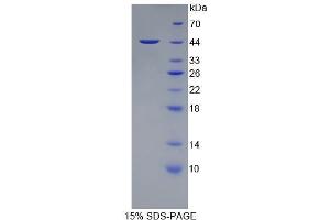 SDS-PAGE (SDS) image for Protein tyrosine Phosphatase, Receptor Type, C (PTPRC) (AA 193-575) protein (His tag) (ABIN1080600)