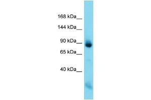 Host: Rabbit  Target Name: Nefm  Sample Tissue: Rat Muscle lysates  Antibody Dilution: 1. (NEFM anticorps  (C-Term))