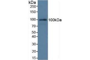 Detection of C7 in Rat Serum using Polyclonal Antibody to Complement Component 7 (C7) (C7 anticorps  (AA 1-144))