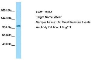 Host: Rabbit  Target Name: Atxn7  Sample Tissue: Rat Small Intestine lysates  Antibody Dilution: 1.