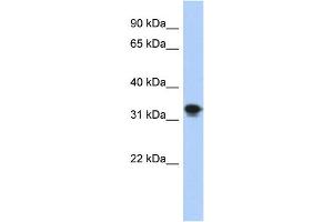 WB Suggested Anti-CENPP Antibody Titration: 0. (CENPP anticorps  (N-Term))