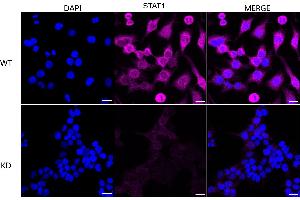 Immunocytochemical staining of HeLa cells using STAT1 antibody (ABIN7800336), 1:1,000), Top panel: wild-type (WT), Bottom panal: STAT1 shRNA knockdown (KD). (Recombinant STAT1 anticorps)