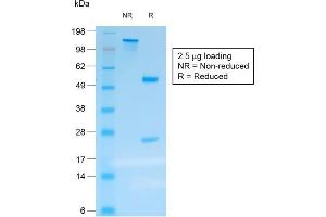 SDS-PAGE Analysis Purified Chromogranin A Mouse Recombinant Monoclonal Ab (rCHGA/413). (Recombinant Chromogranin A anticorps)