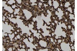 ABIN6264405 and ABIN6274040 at 1/100 staining Mouse lung tissue by IHC-P. (PRC1 anticorps  (Internal Region))