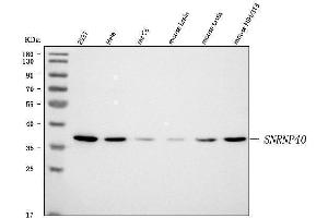 Western blot analysis of SNRNP40 using anti-SNRNP40 antibody (ABIN7601719). (SNRNP40 anticorps  (AA 43-357))