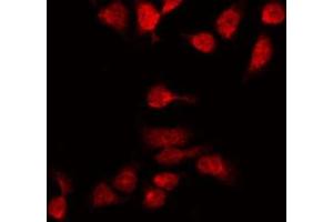 ABIN6269259 staining 293 by IF/ICC. (GATA4 anticorps  (Internal Region))