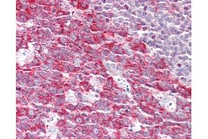 Anti-FMNL1 antibody IHC staining of human tonsil.