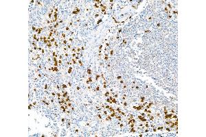Immunohistochemistry (IHC) image for anti-S100 Calcium Binding Protein A9 (S100A9) (AA 64-114) antibody (ABIN7449432)