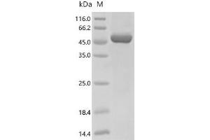 (Tris-Glycine gel) Discontinuous SDS-PAGE (reduced) with 5 % enrichment gel and 15 % separation gel.