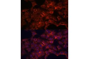 Immunofluorescence analysis of C6 cells using PDP2 antibody (ABIN7269776) at dilution of 1:100.