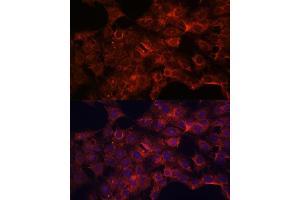 Immunofluorescence analysis of C6 cells using PDP2 antibody (ABIN7269776) at dilution of 1:100. (PDP2 anticorps  (AA 67-250))