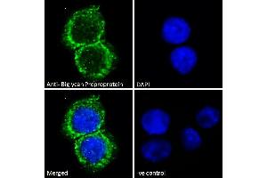ABIN334359 Immunofluorescence analysis of paraformaldehyde fixed HepG2 cells, permeabilized with 0.
