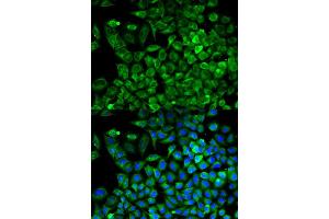 Immunofluorescence analysis of A549 cell using ALDOA antibody. (ALDOA anticorps)