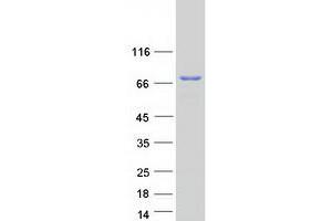 Validation with Western Blot