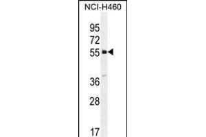 SHISA6 Antibody (N-term) (ABIN655856 and ABIN2845263) western blot analysis in NCI- cell line lysates (35 μg/lane). (SHISA6 anticorps  (N-Term))