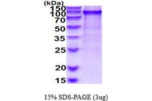 SDS-PAGE (SDS) image for SUMO1 Activating Enzyme Subunit 2 (UBA2) (AA 1-640) protein (His tag) (ABIN6387816)