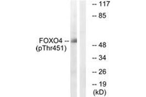 Western blot analysis of extracts from HuvEc cells treated with EGF 200ng/ml 5', using FOXO4 (Phospho-Thr451) Antibody. (FOXO4 anticorps  (pThr451))