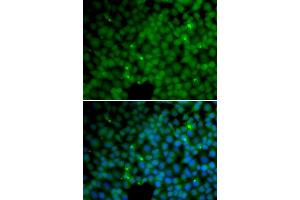 Immunofluorescence analysis of HeLa cells using GGH antibody (ABIN5973177). (GGH anticorps)