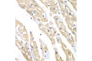 Immunohistochemistry of paraffin-embedded mouse heart using CCT3 antibody. (CCT3 anticorps  (AA 1-300))