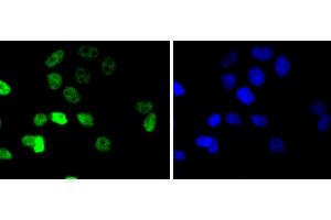 MCF-7 cells were stained with Cyclin E1 (4H7) Monoclonal Antibody  at [1:200] incubated overnight at 4C, followed by secondary antibody incubation, DAPI staining of the nuclei and detection. (Cyclin E1 anticorps)
