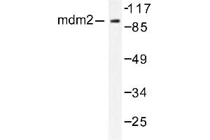 Image no. 1 for anti-Mdm2, p53 E3 Ubiquitin Protein Ligase Homolog (Mouse) (MDM2) antibody (ABIN265516) (MDM2 anticorps)