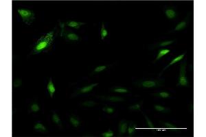 Immunofluorescence of monoclonal antibody to PSME2 on HeLa cell. (PSME2 anticorps  (AA 1-239))