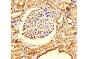 Immunohistochemistry of paraffin-embedded human kidney tissue using ABIN7143697 at dilution of 1:100 (GALM anticorps  (AA 2-342))