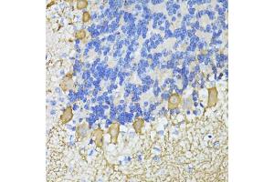 Immunohistochemistry of paraffin-embedded mouse cerebellum using C antibody  at dilution of 1:100 (40x lens). (CA8 anticorps  (AA 1-290))