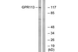 Western blot analysis of extracts from LOVO cells, using GPR113 Antibody. (GPR113 anticorps  (AA 21-70))
