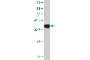 Western Blot detection against Immunogen (37. (FOXA1 anticorps  (AA 367-472))