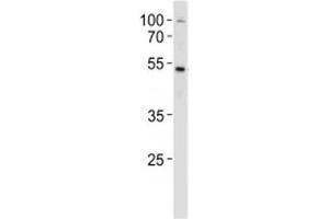 SOX4 antibody western blot analysis in MCF-7 lysate.