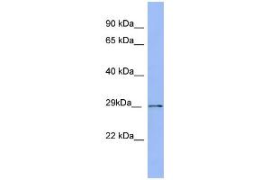 WB Suggested Anti-PSMA5 Antibody Titration: 0.