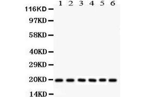 Anti- PIN1 Picoband antibody, Western blotting All lanes: Anti PIN1  at 0. (PIN1 anticorps  (AA 1-163))