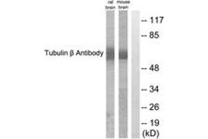 Western blot analysis of extracts from mouse brain/rat brain cells, using Tubulin beta Antibody. (TUBB anticorps  (AA 401-450))
