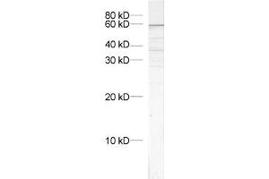 dilution: 1 : 1000, sample: crude synaptosomal fraction of rat brain (P2) (VPS45 anticorps)