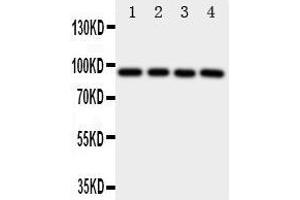 Western Blotting (WB) image for anti-Aryl Hydrocarbon Receptor (AHR) (AA 832-848), (C-Term) antibody (ABIN3043054) (Aryl Hydrocarbon Receptor anticorps  (C-Term))