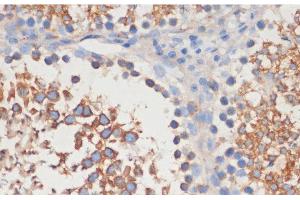 Immunohistochemistry of paraffin-embedded Rat testis using CDC42 Polyclonal Antibody at dilution of 1:100 (40x lens). (CDC42 anticorps)