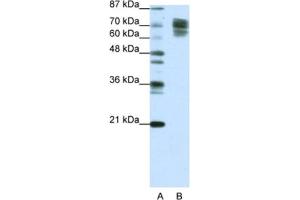 Western Blotting (WB) image for anti-Catenin (Cadherin-Associated Protein), beta 1, 88kDa (CTNNB1) antibody (ABIN2463774) (CTNNB1 anticorps)