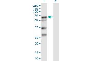 Western Blot analysis of SERPINA10 expression in transfected 293T cell line by SERPINA10 MaxPab polyclonal antibody.