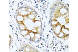 Immunohistochemistry of paraffin-embedded Human colon using PRKCA Polyclonal Antibody at dilution of 1:100 (40x lens).
