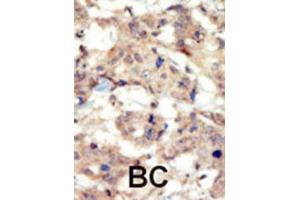 Immunohistochemistry (IHC) image for anti-EPH Receptor B6 (EPHB6) antibody (ABIN5023506) (EPH Receptor B6 anticorps)