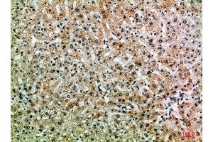 Immunohistochemical analysis of paraffin-embedded Human-liver, antibody was diluted at 1:100