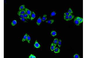 Immunofluorescent analysis of HepG2 cells using ABIN7142316 at dilution of 1:100 and Alexa Fluor 488-congugated AffiniPure Goat Anti-Rabbit IgG(H+L)
