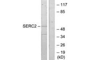 Western blot analysis of extracts from HeLa cells, using SERC2 Antibody. (PSAT1 anticorps  (AA 341-390))