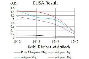 Black line: Control Antigen (100 ng), Purple line: Antigen(10 ng), Blue line: Antigen (50 ng), Red line: Antigen (100 ng), (RAP1A anticorps)