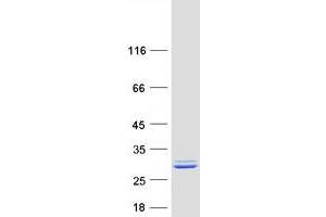 Validation with Western Blot