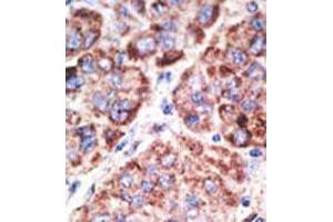 Image no. 2 for anti-Toll-Like Receptor 6 (TLR6) (N-Term) antibody (ABIN357054)