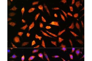 Immunofluorescence analysis of L929 cells using BNP Polyclonal Antibody at dilution of 1:100. (BNP anticorps)